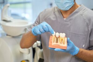 Scopri di più sull'articolo Impianti dentali: tutto ciò che devi sapere sulla procedura