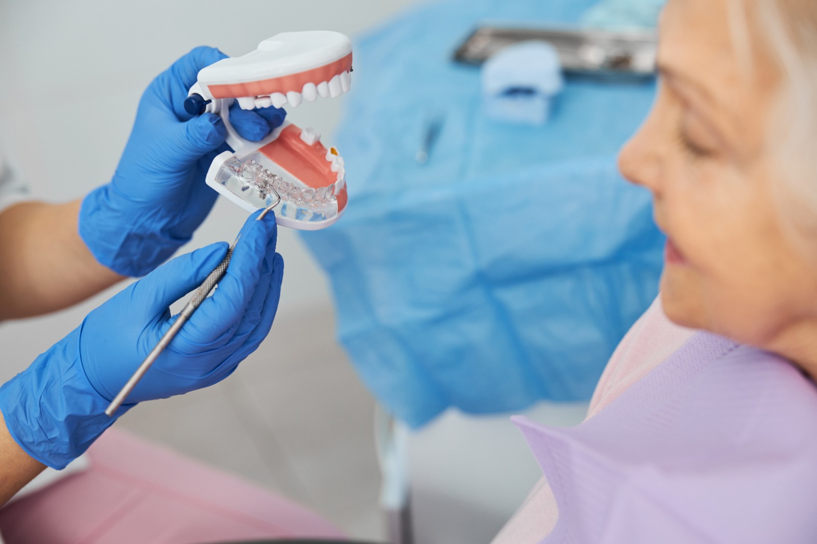 Al momento stai visualizzando Quali sono le diverse tipologie di impianti dentali disponibili?